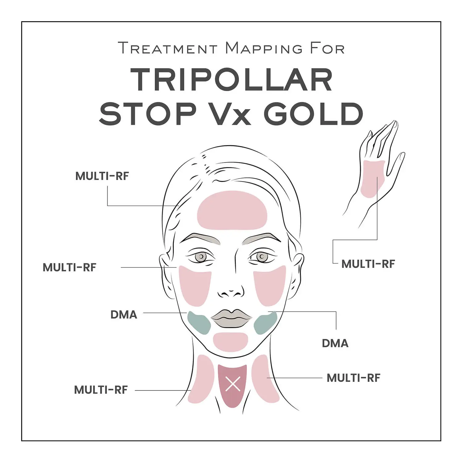 TriPollar STOP VX GOLD anti-aging uređaj za lice