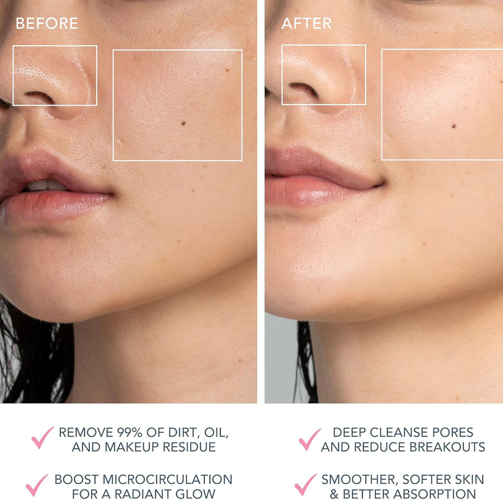 Uređaj za čišćenje luca Foreo Luna 4 mini Pearl Pink